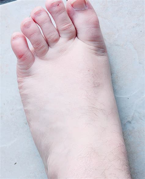 Gross Foot Stock Photos and Pictures